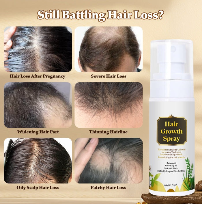Natural Hair Growth Oil - Battana Rosemary Serum Biotin Caffeine Scalp Treatment - Thinning Hair Regrowth And Thickening For Women And Men-It Is Forbidden To Sell On The TikTok Platform